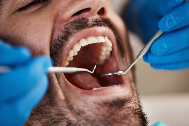 Best Broken or Chipped Tooth Repair in Henagar, AL